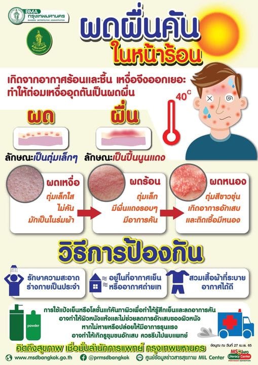 ช่วงหน้าร้อน อากาศที่ร้อนอบอ้าวอาจเป็นปัจจัยสำคัญที่ทำให้เกิดโรคผิวหนังชนิดต่างๆ